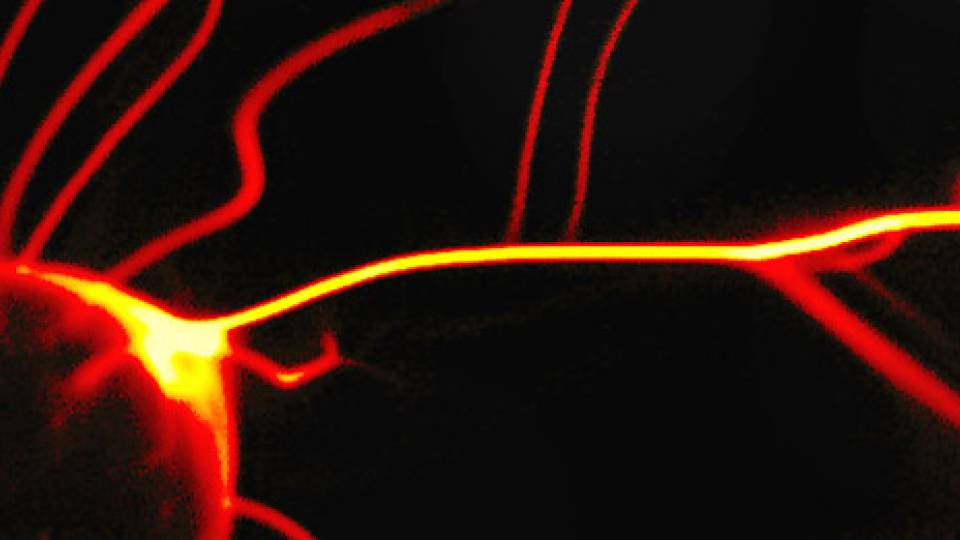 Plasma ball