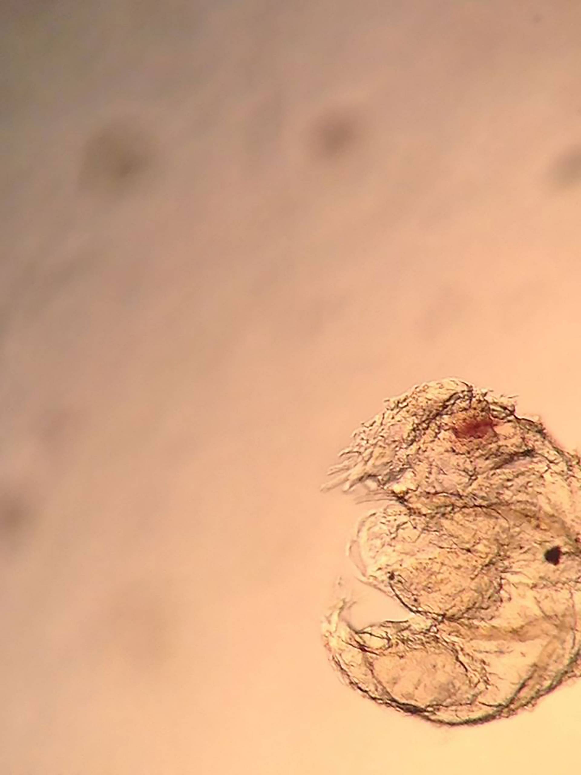 brain of a mosquito