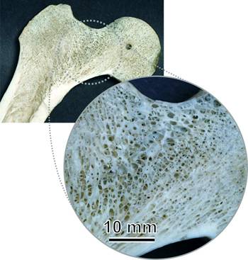 Bone diagram