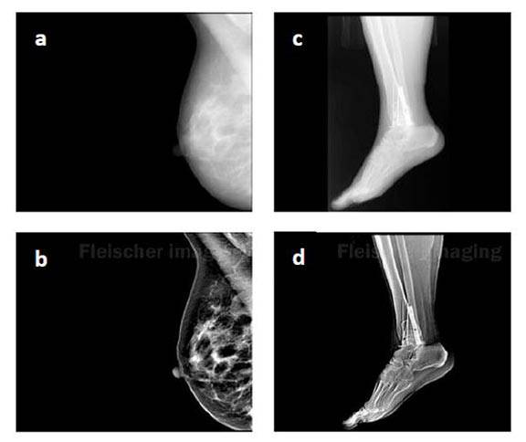 Fleischer Xray